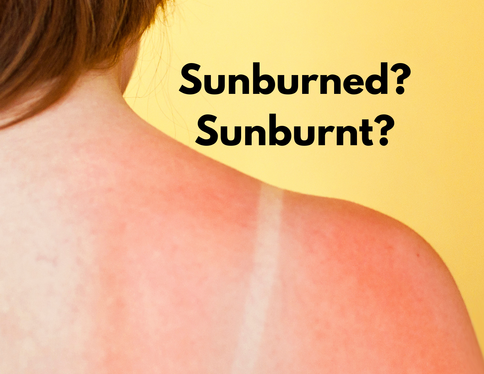 A picture of a woman with a sunburn and the words sunburned or sunburnt?